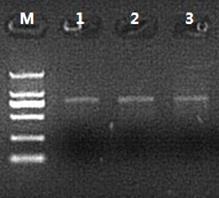 cDNA 第二鏈合成